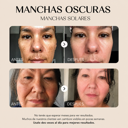 Eliminá las manchas oscuras  Desde tu casa en pocos minutos al día