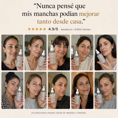 Eliminá las manchas oscuras  Desde tu casa en pocos minutos al día